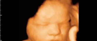 Фото трехмерного УЗИ в 38 недель беременности