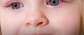 гноение глаз у ребенка