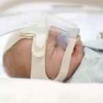 Treatment of apnea in infants using a CPAP machine