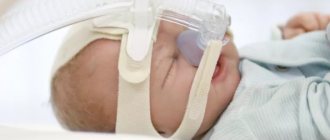 Лечение апноэ у младенцев при помощи СИПАП-аппарата