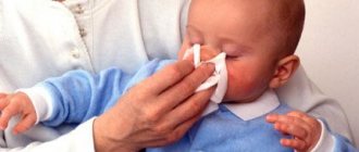 Runny nose in a baby
