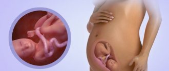 Fetus at 27 weeks of gestation