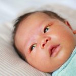 Jaundice in newborns: causes and consequences
